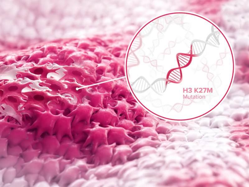 脑癌宣传月：关注罕见脑肿瘤患者，分子检测至关重要