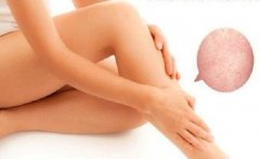 华东医药罗氟司特乳膏中国上市申请获受理