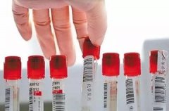 高效靶向胰腺！新型AAV载体问世，精准转导胰岛细胞