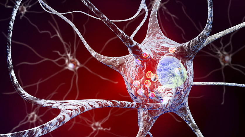 历经2023年遭拒后，Amneal的帕金森病缓释药物Crexont终获批准